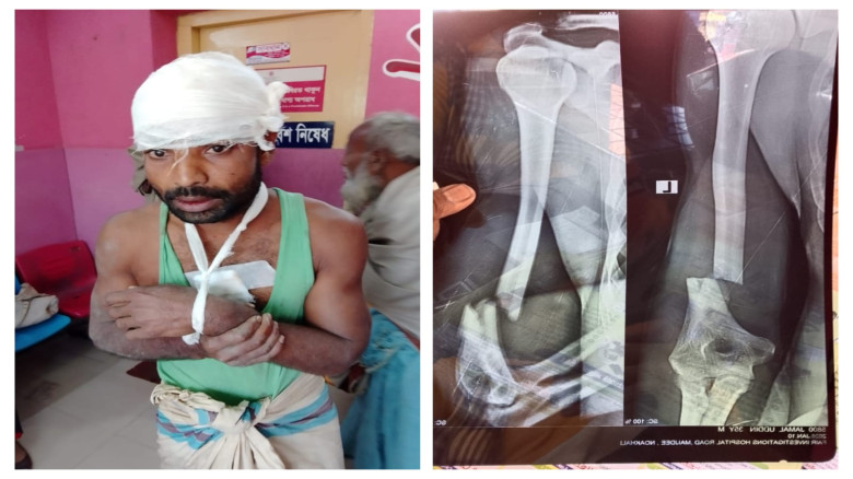 নোয়াখালীতে অস্ত্র দিয়ে কৃষকের হাত ভেঙে কুপিয়ে জখম...